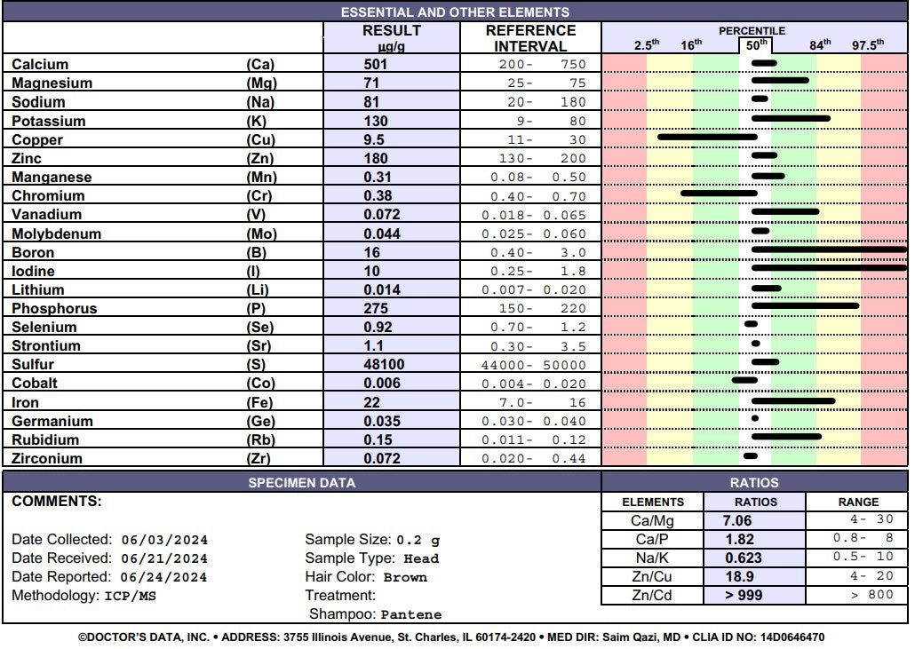 Hair Element's Test by Doctor's Data Lab USA